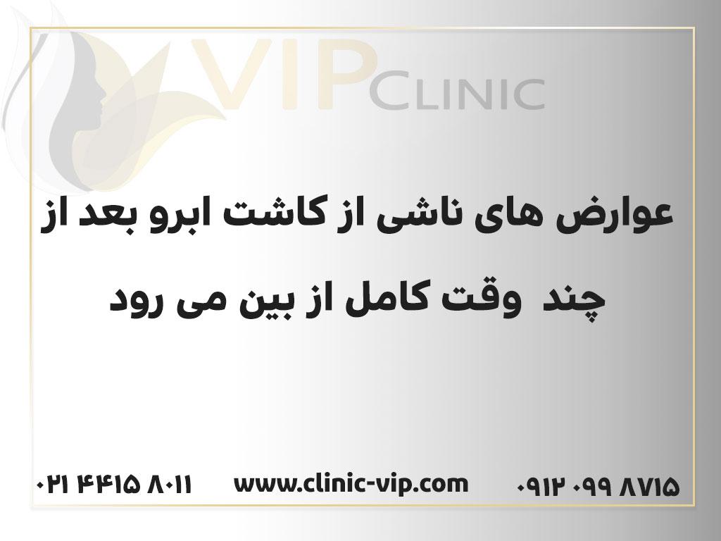 عوارض کاشت مو-کلینیک vip