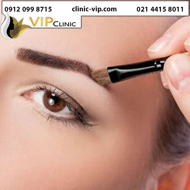 سوالات-متداول-بعد-از-کاشت-ابرو