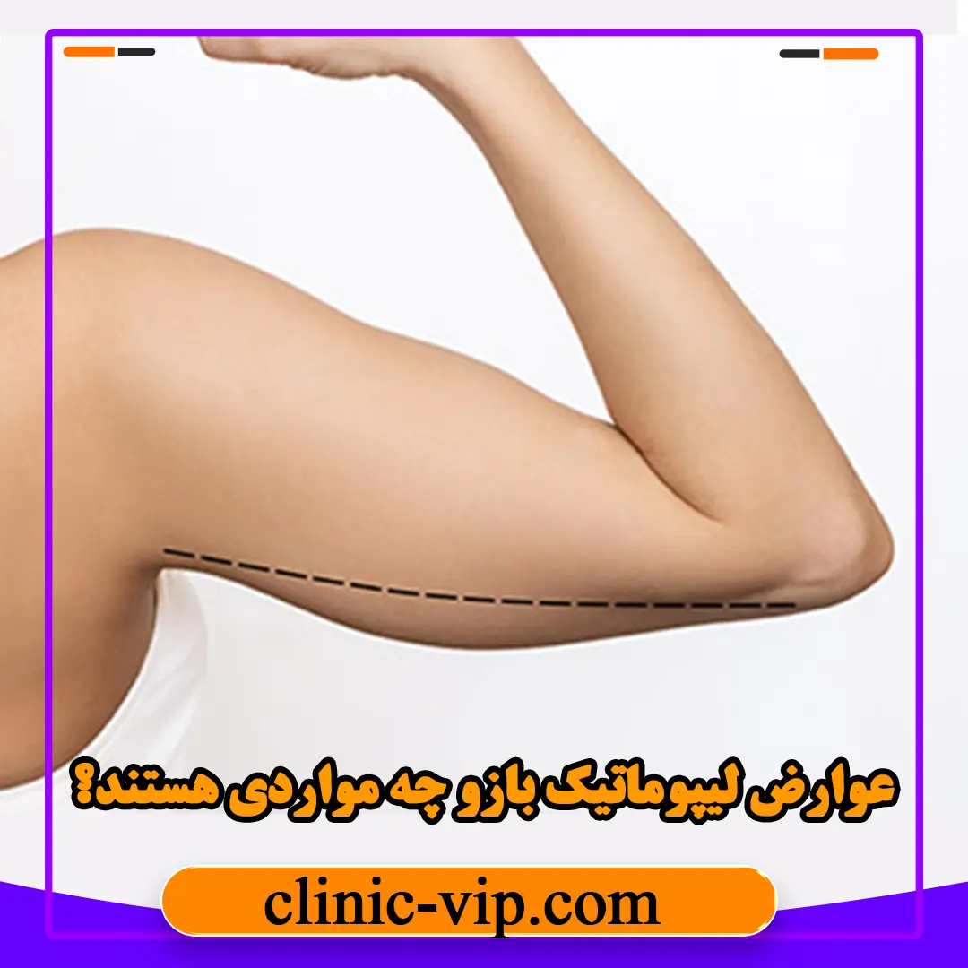 عوارض لیپوماتیک بازو چه مواردی هستند؟